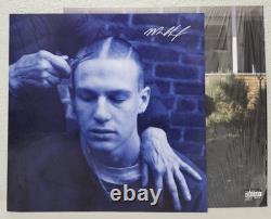 Malcolm Todd Exclusive Autographed Vinyl Signed Seam Split See Pictures