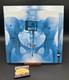Disque Vinyle SignÉ Lorde Virgin Lp Disque Vinyle Noir SignÉ Double Autographe Variante Rare B