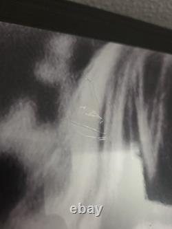 TAME IMPALA Deadbeat VINYLE 2LP SIGNÉ Autographié EN MAIN, EXPÉDIÉ MAINTENANT